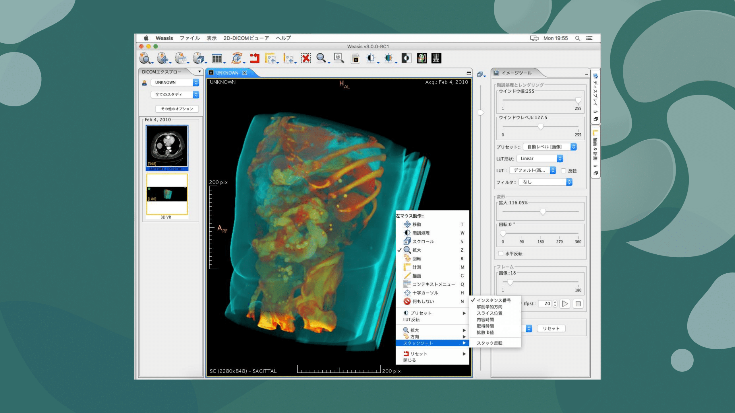 como-instalar-o-weasis-um-visualizador-dicom-no-linux