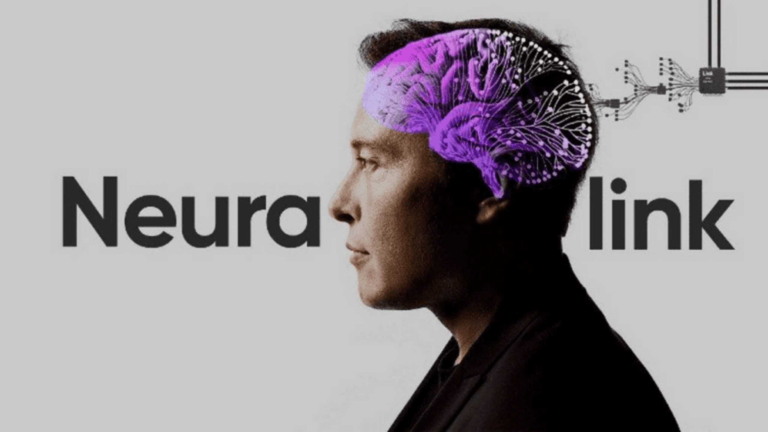 implante-neuralink-sera-testado-em-humanos-em-2023