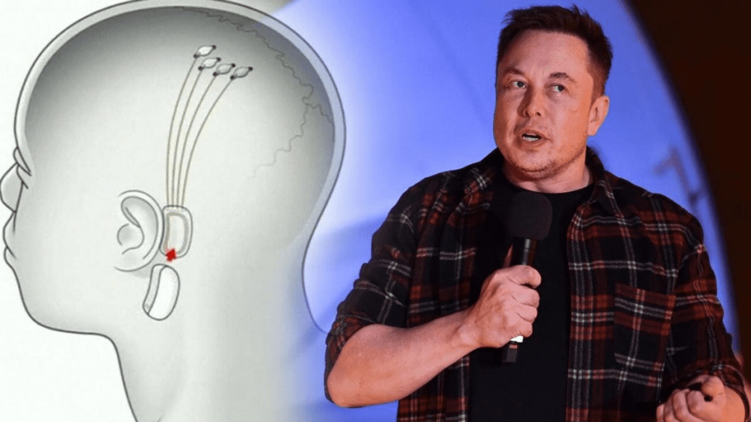 implante-neuralink-sera-testado-em-humanos-em-2023