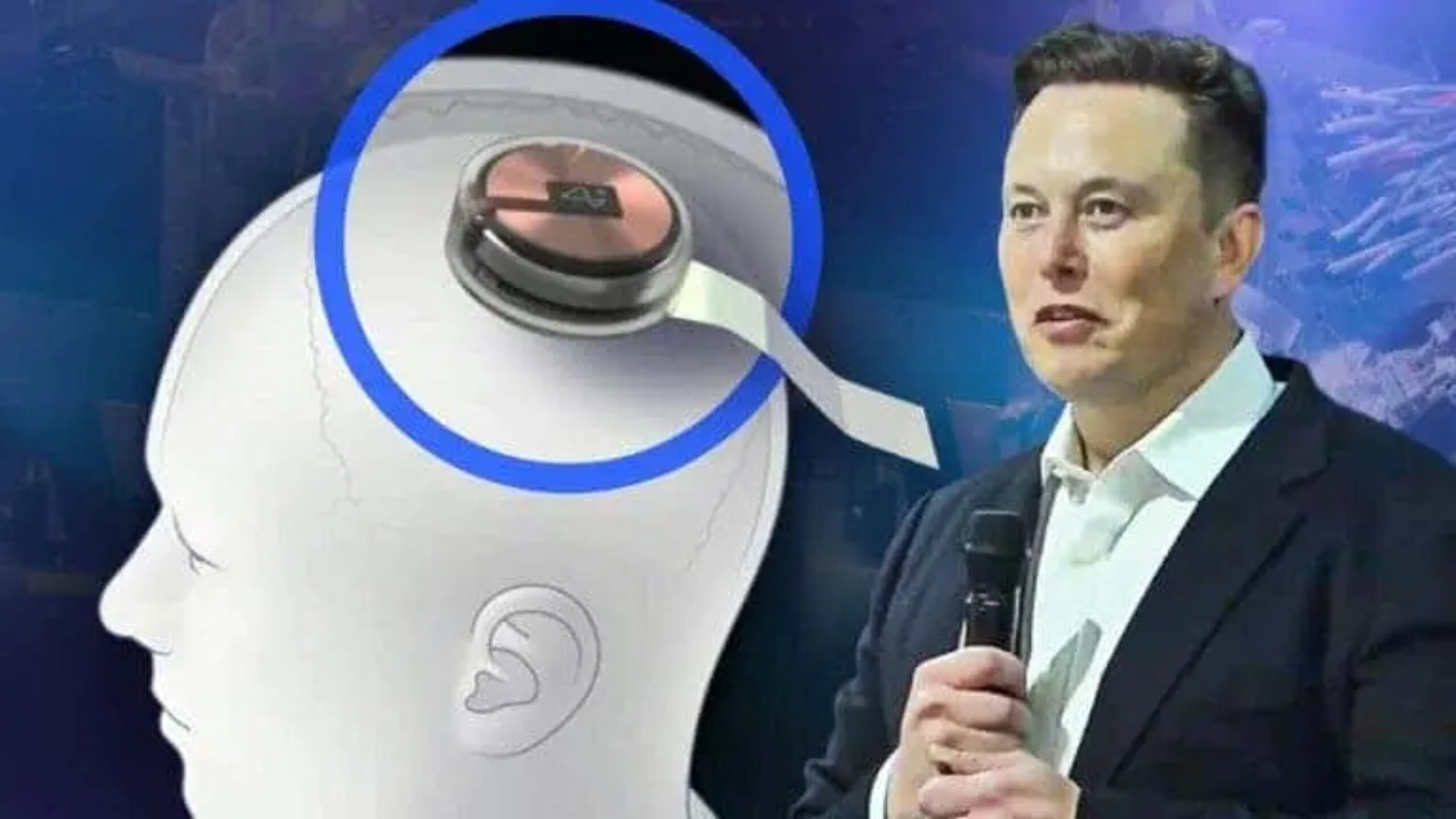 fda-nega-pedido-de-neuralink-para-testar-implantes-cerebrais-em-humanos