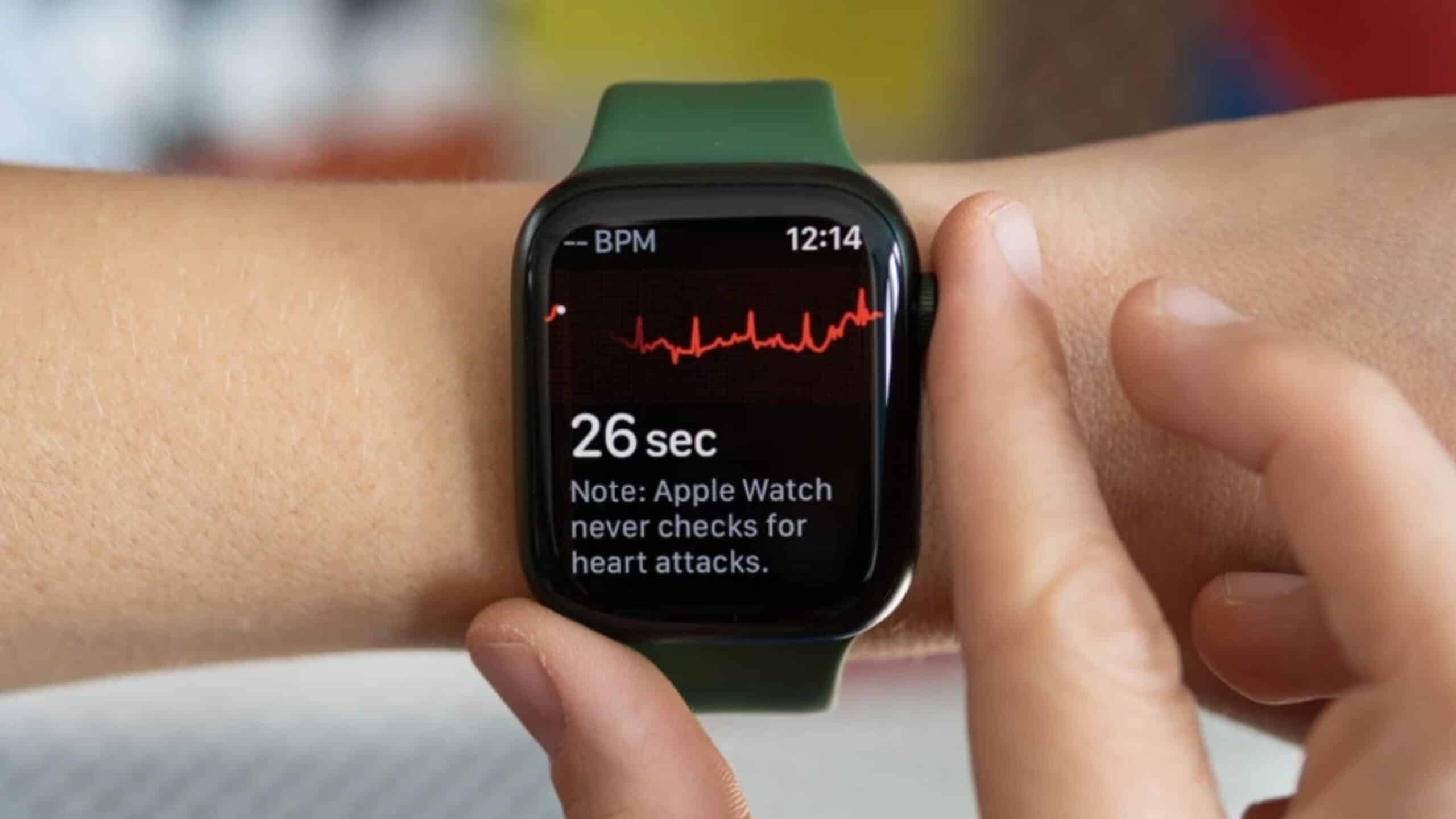 Imagem de Apple Watch